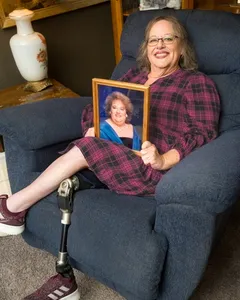 SBL Bariatric Program, SBL medical Exercise Program